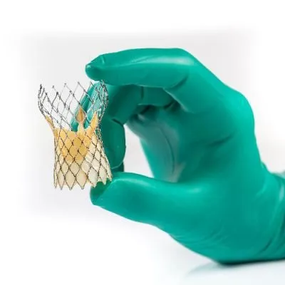 A gloved hand holding a transcatheter aortic valve replacement (TAVR) device.